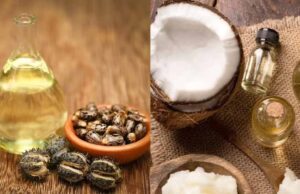 नारियल तेल बनाम कैस्टर ऑयल: कौन सा है आपके बालों के लिए सबसे फायदेमंद?