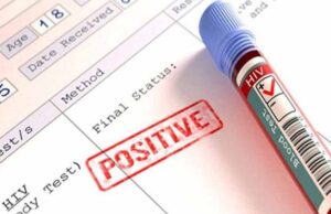 HIV रिपोर्ट गोपनीयता पर नई गाइडलाइन: अब सिर्फ डॉक्टर ही देख सकेंगे मरीज की जानकारी
