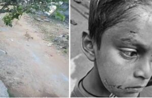 बिलासपुर में PM श्री स्कूल के अंदर कुत्ते ने पहली कक्षा के बच्चे को नोचा, बचाने दौड़ी टीचर पर भी किया हमला