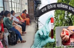 पीएमसीएच में अब सिर्फ 3 दिन खून की जांच, डॉक्टरों की कमी के चलते लिया फैसला
