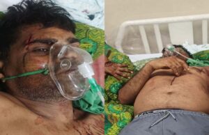 कुल्हाड़ी से हमला: गाली-गलौज का विरोध करने पर पूर्व जनपद सदस्य प्रतिनिधि पर जानलेवा वार