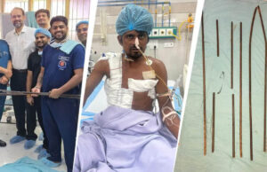 शरीर में आर-पार घुसे 4 लोहे के सरिये, KGMU के डॉक्टरों ने साढ़े आठ घंटे की सर्जरी से बचाई मजदूर की जान