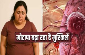 मोटापा-तनाव बढ़ा रहे कैंसर का खतरा! पुरुषों में ओरल तो महिलाओं में ब्रेस्ट कैंसर के मामले बढ़े