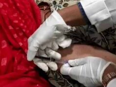 इंदौर MY अस्पताल में लाखों का बोटोक्स इलाज मुफ्त, लकवे के बाद जकड़े हाथ-पैरों में लौट रही हरकत